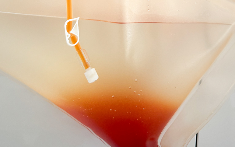 Beispielbilder Eluat nach der Toxopherese®